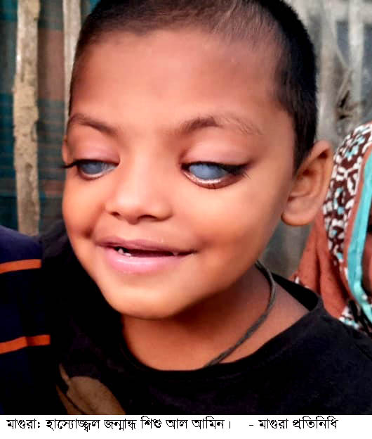 Magura Blind Child Al Amin Pic 2